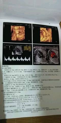 journal_insert_pic_1131496575