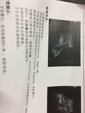 journal_insert_pic_1132445523