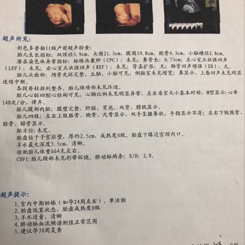 journal_insert_pic_1132838672