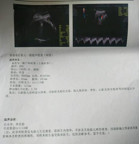 journal_insert_pic_1132741737