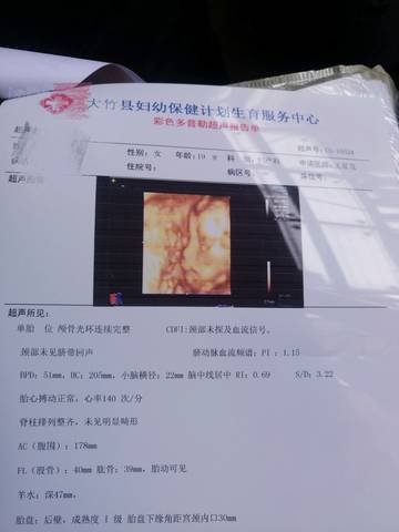 journal_insert_pic_1133486351