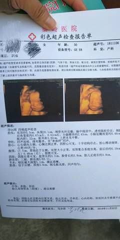 journal_insert_pic_1134451472