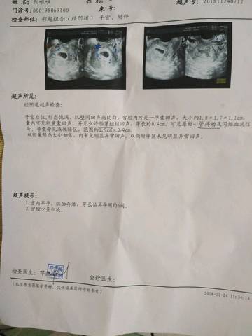 journal_insert_pic_1135827235