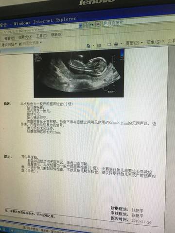 journal_insert_pic_1137628836