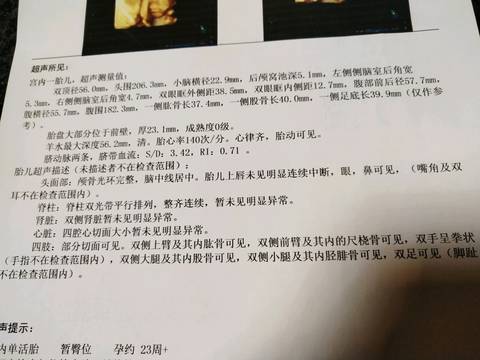 journal_insert_pic_1138449382
