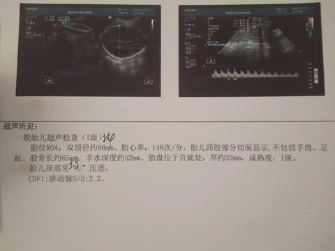 journal_insert_pic_1138145055