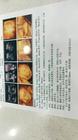 journal_insert_pic_1139077833
