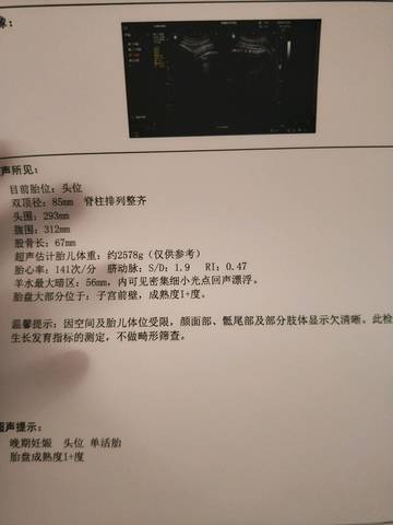 journal_insert_pic_1138859322