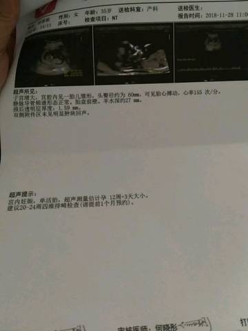 journal_insert_pic_1139030996