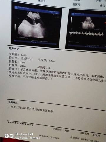 journal_insert_pic_1139774874
