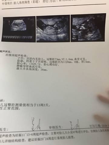 journal_insert_pic_1140562482