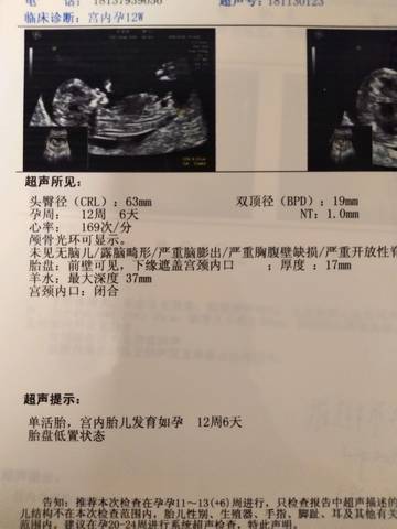 journal_insert_pic_1140646851