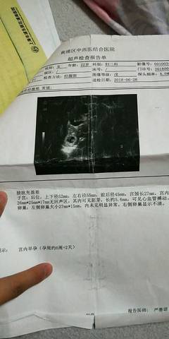 journal_insert_pic_1140847642