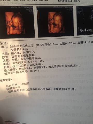 journal_insert_pic_1141496609
