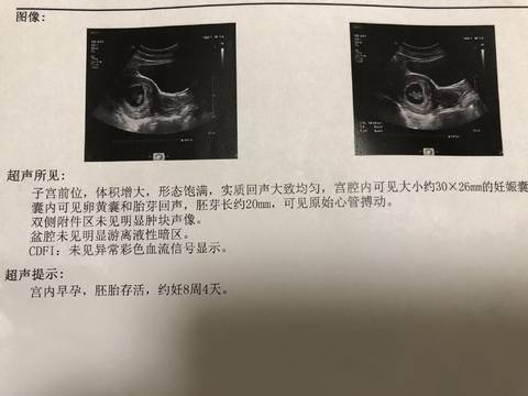 journal_insert_pic_1143348379