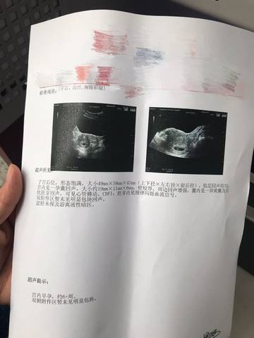 journal_insert_pic_1144390623