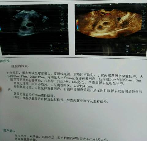 journal_insert_pic_1144893723