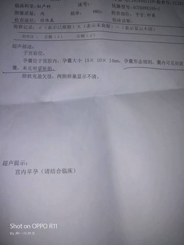 journal_insert_pic_1146221451