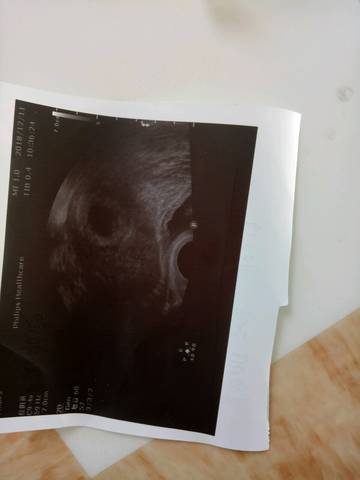 journal_insert_pic_1146730189