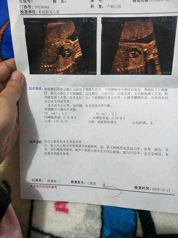 journal_insert_pic_1146909338