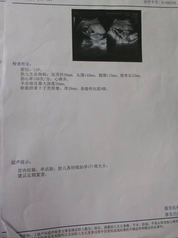 journal_insert_pic_1146981068