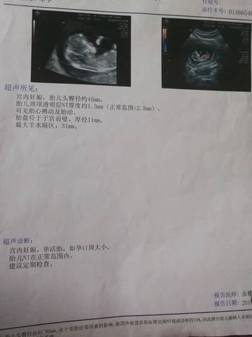 journal_insert_pic_1146981073