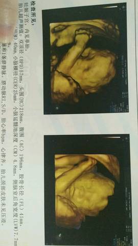 journal_insert_pic_1147231281
