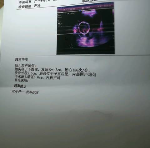 journal_insert_pic_1148870592