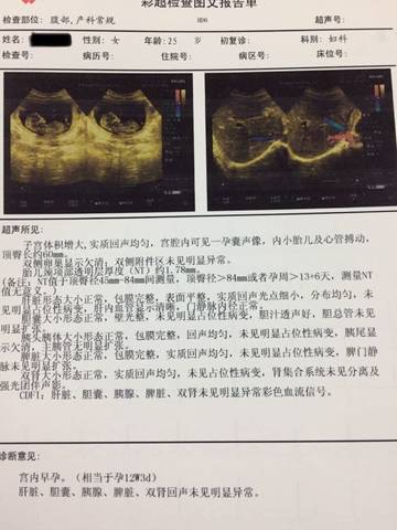 journal_insert_pic_1149884657