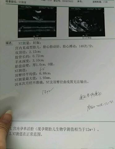 journal_insert_pic_1149702249