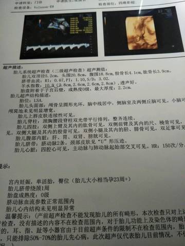 journal_insert_pic_1150267826
