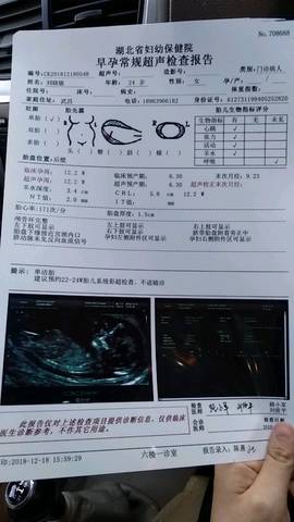 journal_insert_pic_1150674747