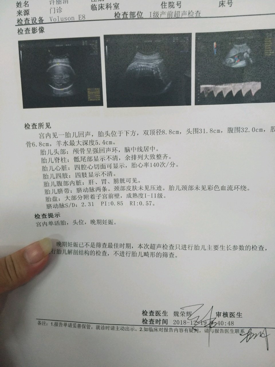 听说B超单上右上角显示的y代表男孩，x代表女孩是真的吗？