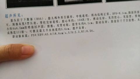 journal_insert_pic_1151429844