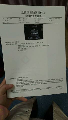 journal_insert_pic_1151815504