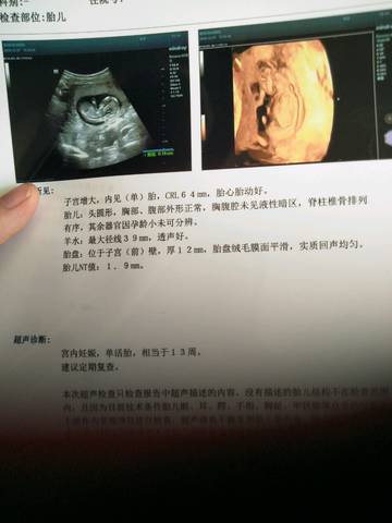 journal_insert_pic_1155483273