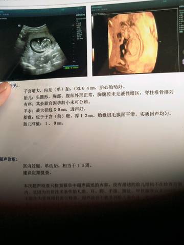 journal_insert_pic_1155483270