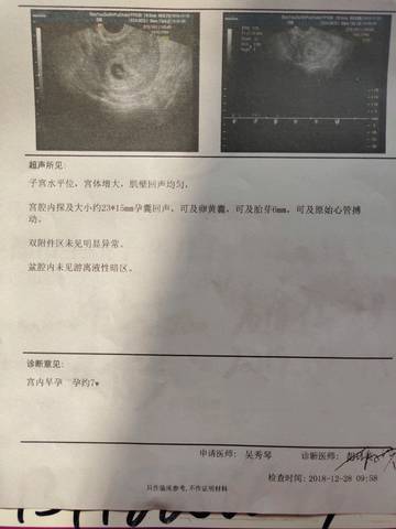 journal_insert_pic_1155899265