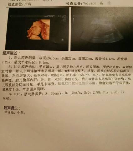 journal_insert_pic_1157775308