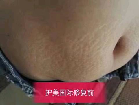 journal_insert_pic_1157398226