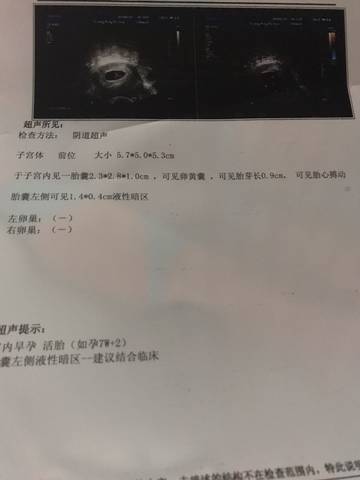 journal_insert_pic_1158363573