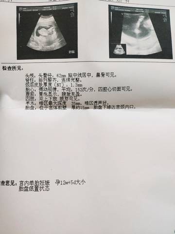 journal_insert_pic_1158831086