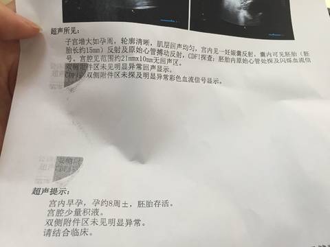 journal_insert_pic_1159719417