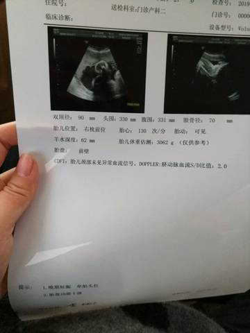 journal_insert_pic_1161556811