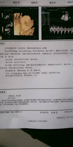 journal_insert_pic_1165699213