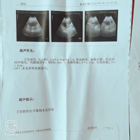 journal_insert_pic_1167424553