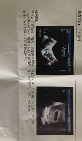 journal_insert_pic_1168067310