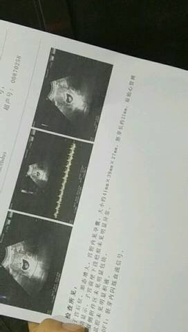journal_insert_pic_1173782328