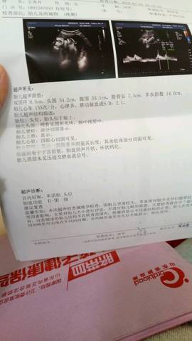 journal_insert_pic_1176247938