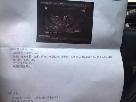 journal_insert_pic_1178869345